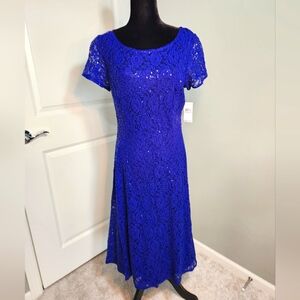 Sparkling Blue Lace Dress